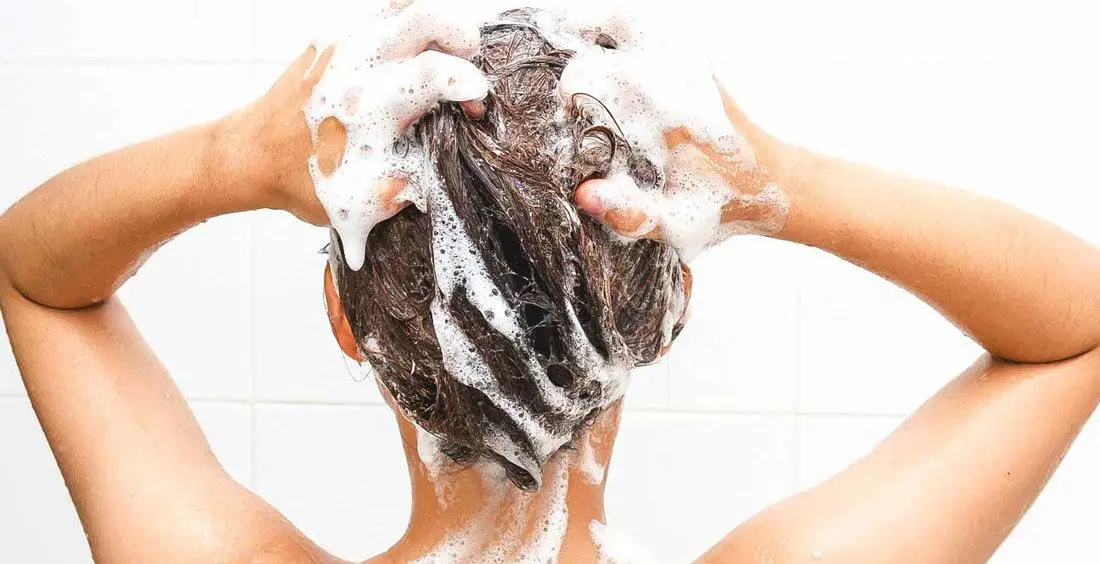 Wash with a dandruff shampoo